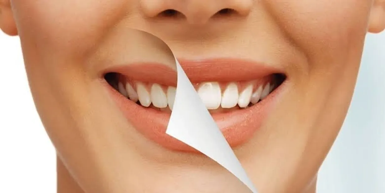 What Is Cosmetic Dentistry and How Can It Transform Your Smile Wembley