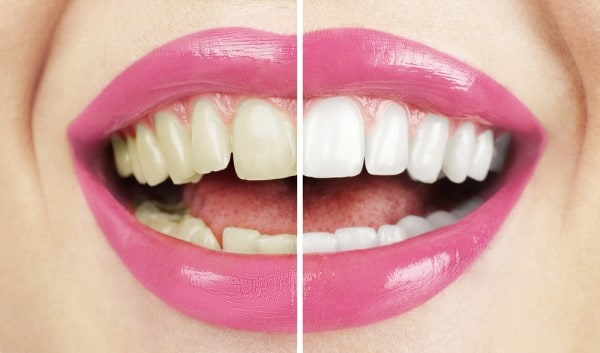 What Early Signs of Oral Cancer Should You Never Ignore Wembley?