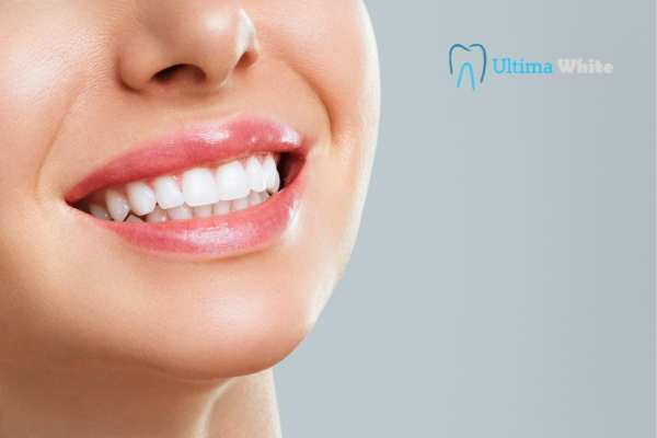 Common Mistakes That Can Ruin Your Whitening Results Wembley