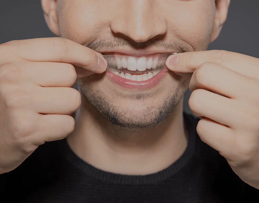 Can You Whiten Natural Teeth Without Harsh Chemicals Wembley?