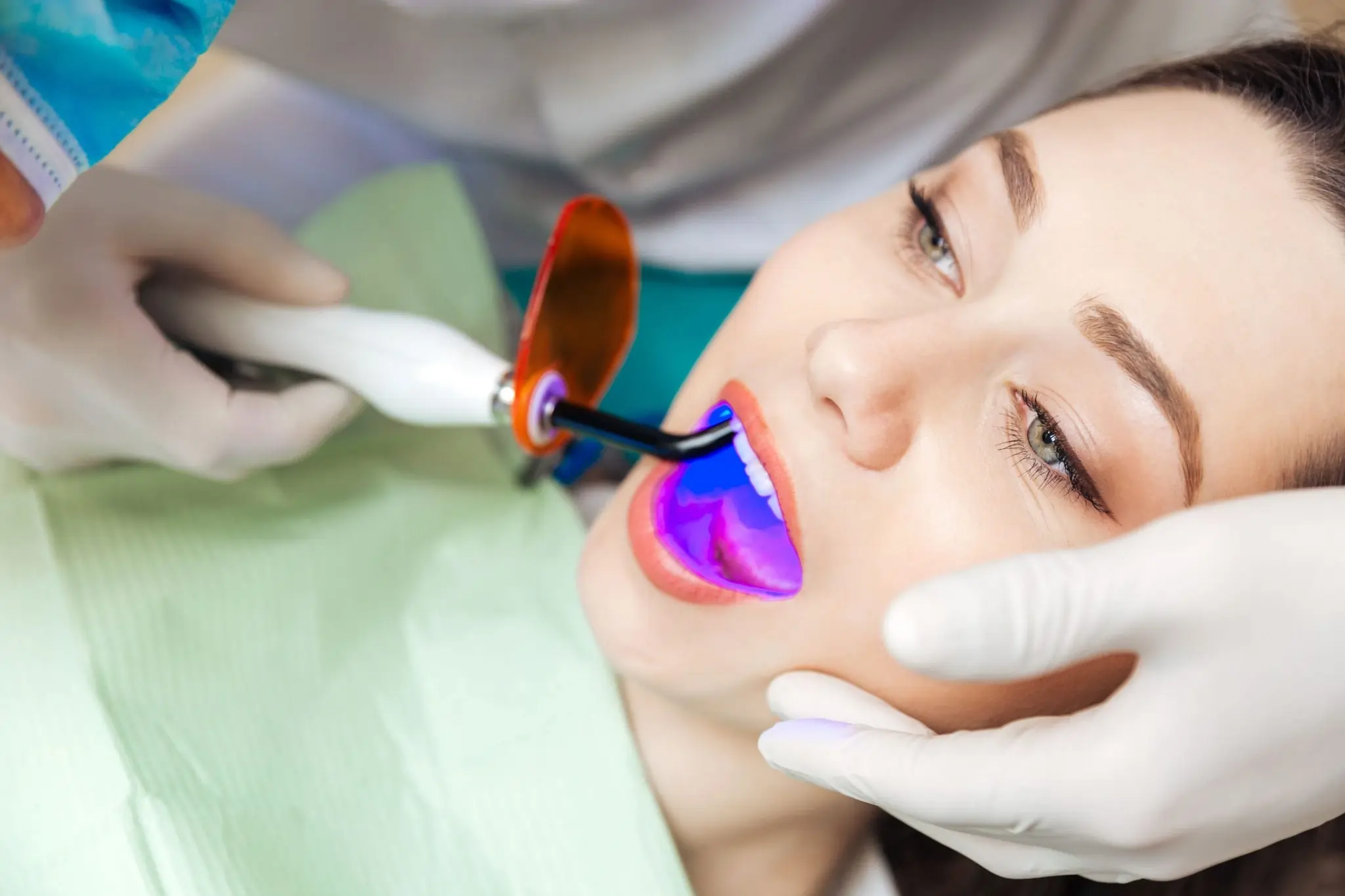 What You Need to Know Before Brightening Your Smile Wembley