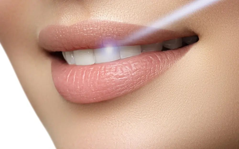 Understanding Teeth Whitening Risks and Results Wembley