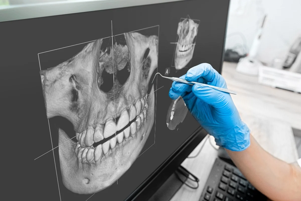 How Is AI Transforming Dental Treatment Planning Wembley?