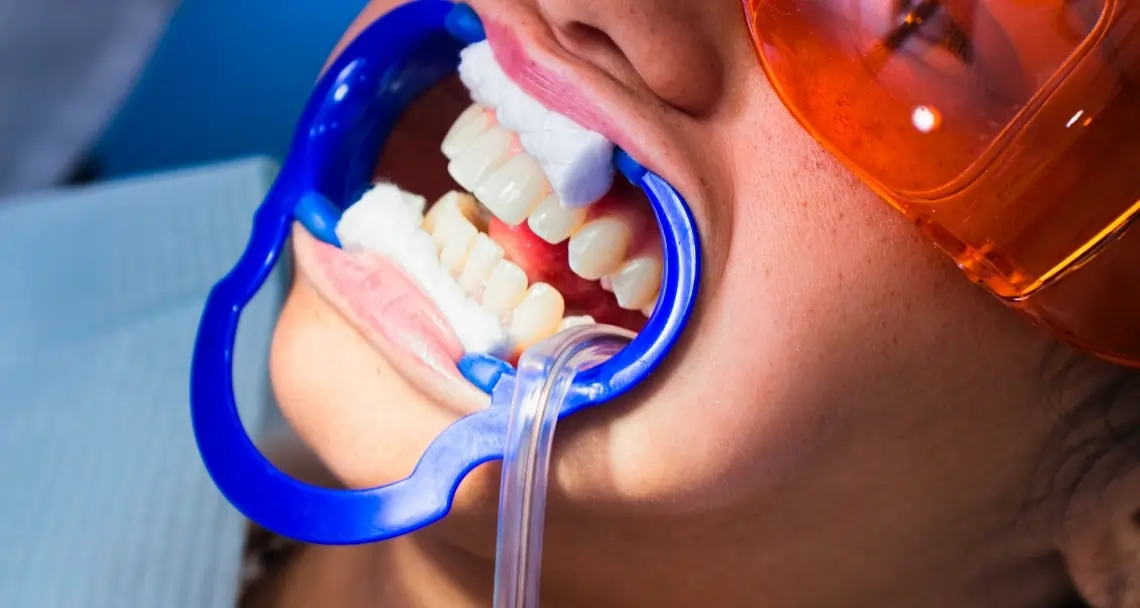 How Can Cosmetic Dentistry Boost Your Confidence Wembley