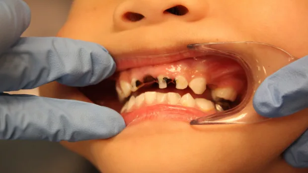 Can Your Diet Help You Achieve a Whiter, Healthier Smile Wembley?