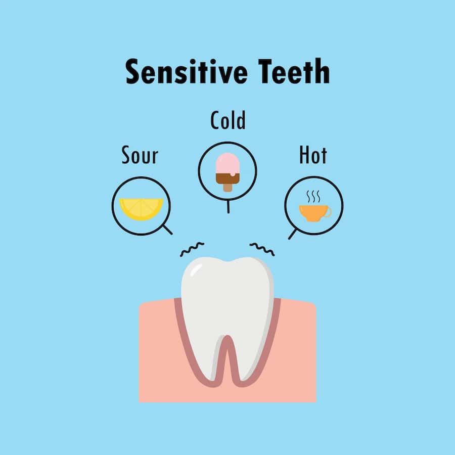 Why Do Teeth Become Sensitive After Whitening Treatments Wembley?