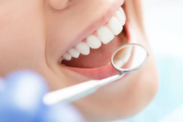 How Much Fluoride Do You Really Need Wembley?