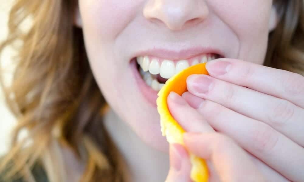 How Long Does Natural Teeth Whitening Take to Show Results Wembley?
