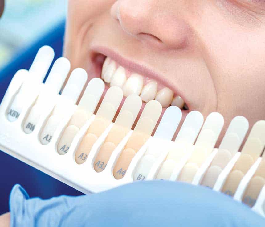 Is Laser Teeth Whitening Worth It for a Brighter, Confident Smile Wembley?