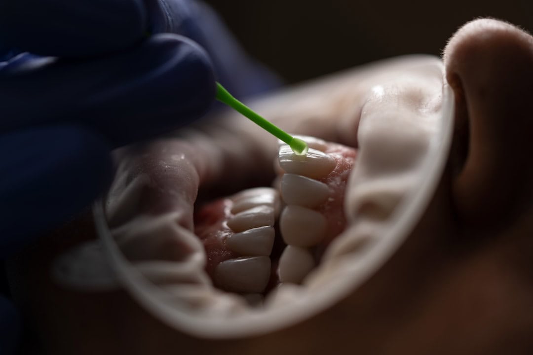 The Role of Saliva: Nature’s Defense System Wembley