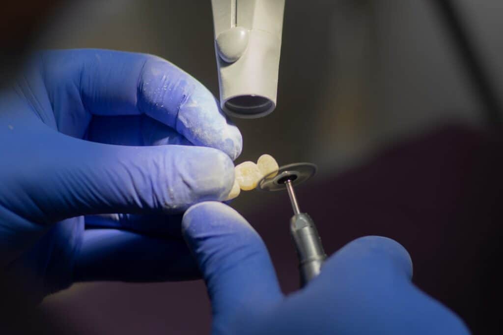 Customised Dental Solutions: Crowns, Aligners, and Implants Wembley